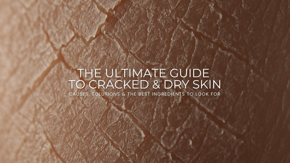 The Ultimate Guide to Cracked & Dry Skin: Causes, Solutions & the Best Ingredients to Look For