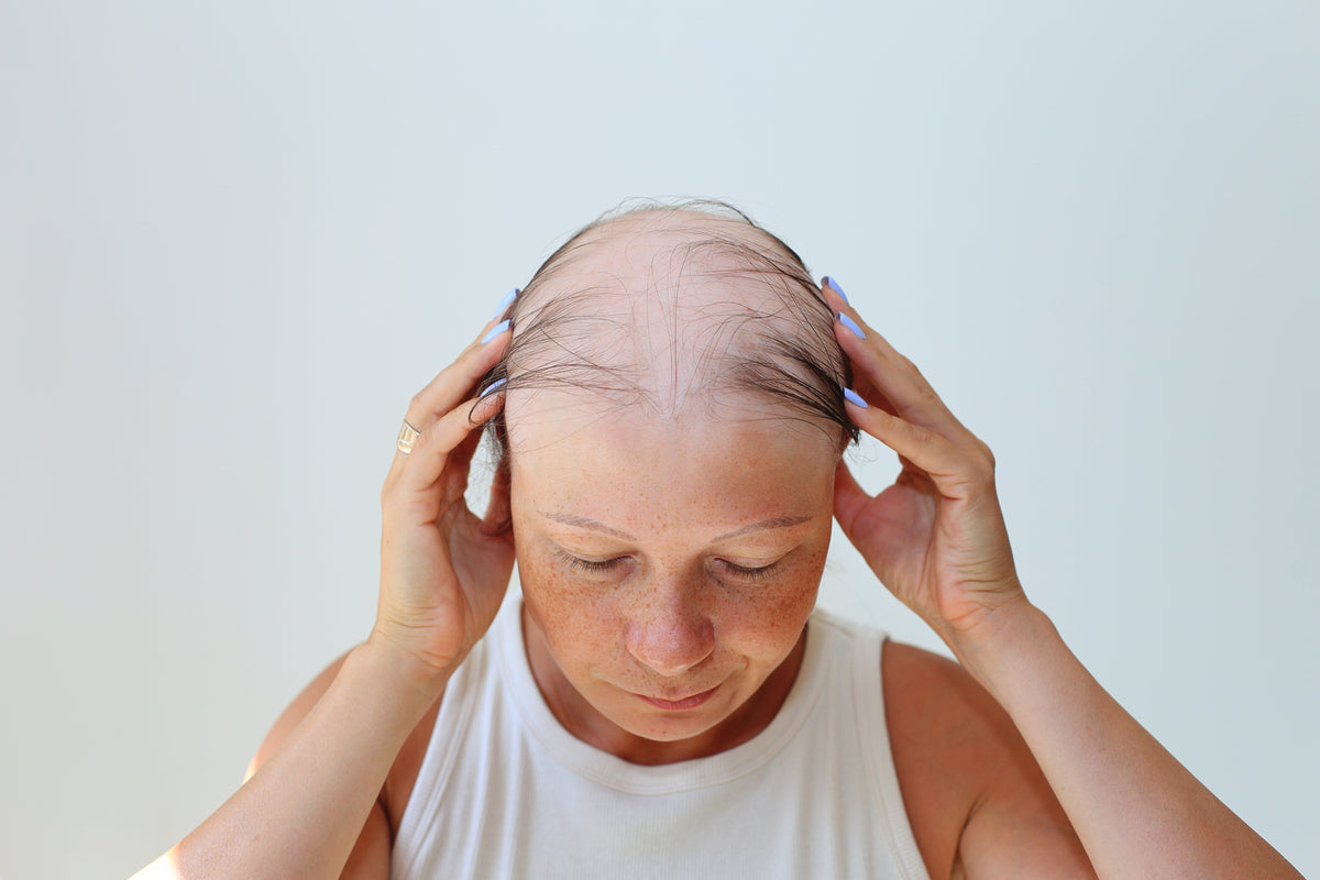 Alopecia: How Angel Cosmoceuticals Supports Hair Health and Scalp Wellness